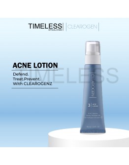 ACNE LOTION